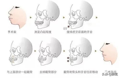 杨超越还能撑多久,杨超越遇到的真实事件