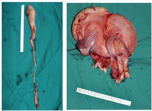 协和医院妇科顶级专家不孕不育,协和医院妇科肿瘤知名专家