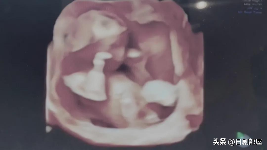 akb48板野友美毕业演唱会,akb48总选举板野友美