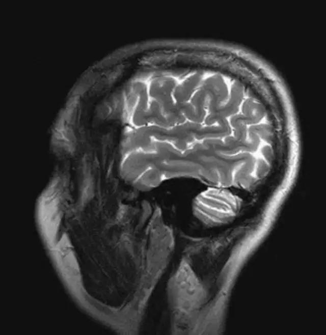 mri临床医师必读电子书,临床医生如何读mri