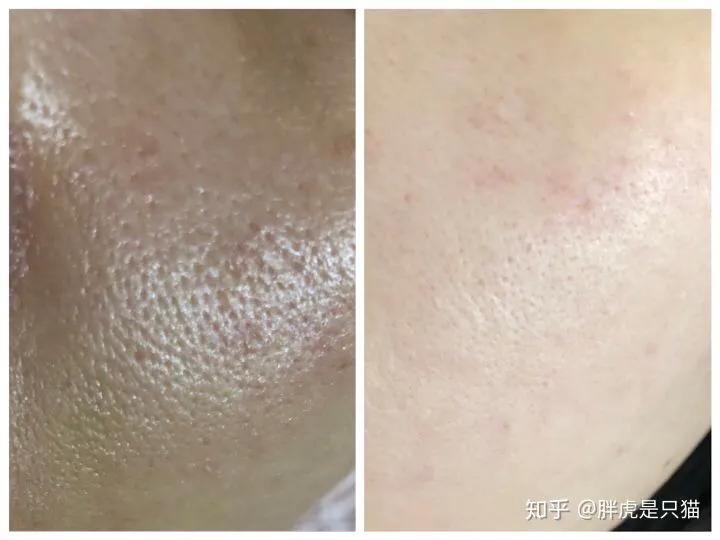 法国菲洛嘉高端抗衰系列,法国菲洛嘉逆时空抗皱眼霜