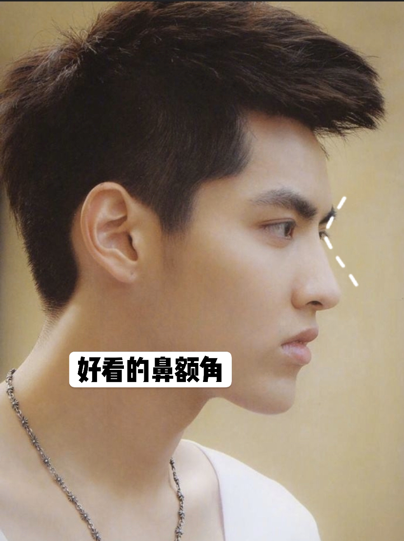 女人鼻子图解通天鼻,肋骨鼻做成了通天鼻怎么改