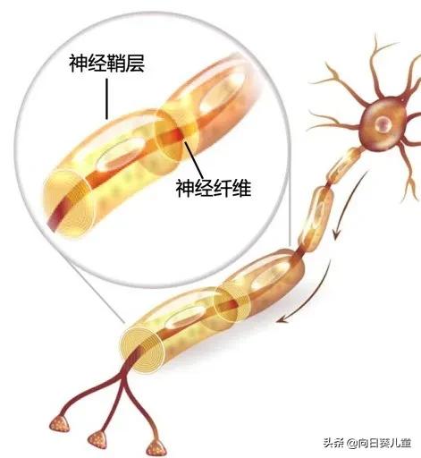 神经纤维瘤2型寿命,神经纤维瘤1型影响身高