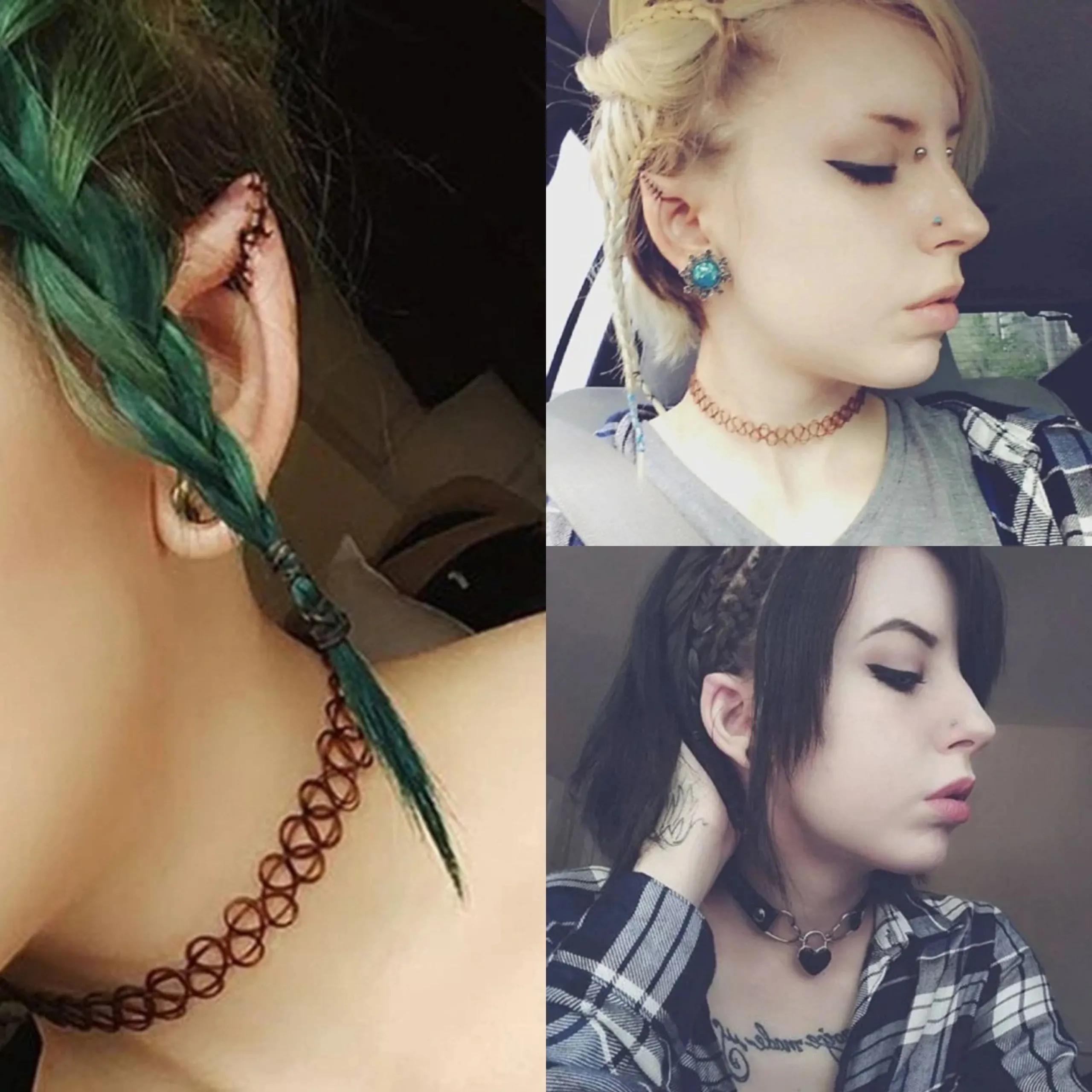 20万玻尿酸,一连打6支玻尿酸会怎么样