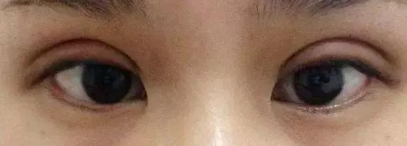 1元脱毛靠谱吗,0元免费脱毛