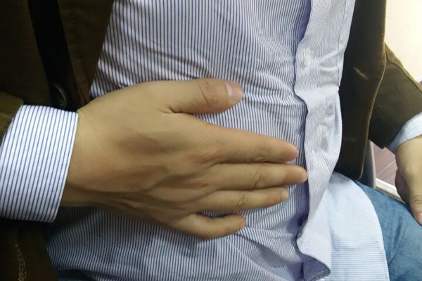 肝脏不好脸上图片,肝脏不好在脸上的表现