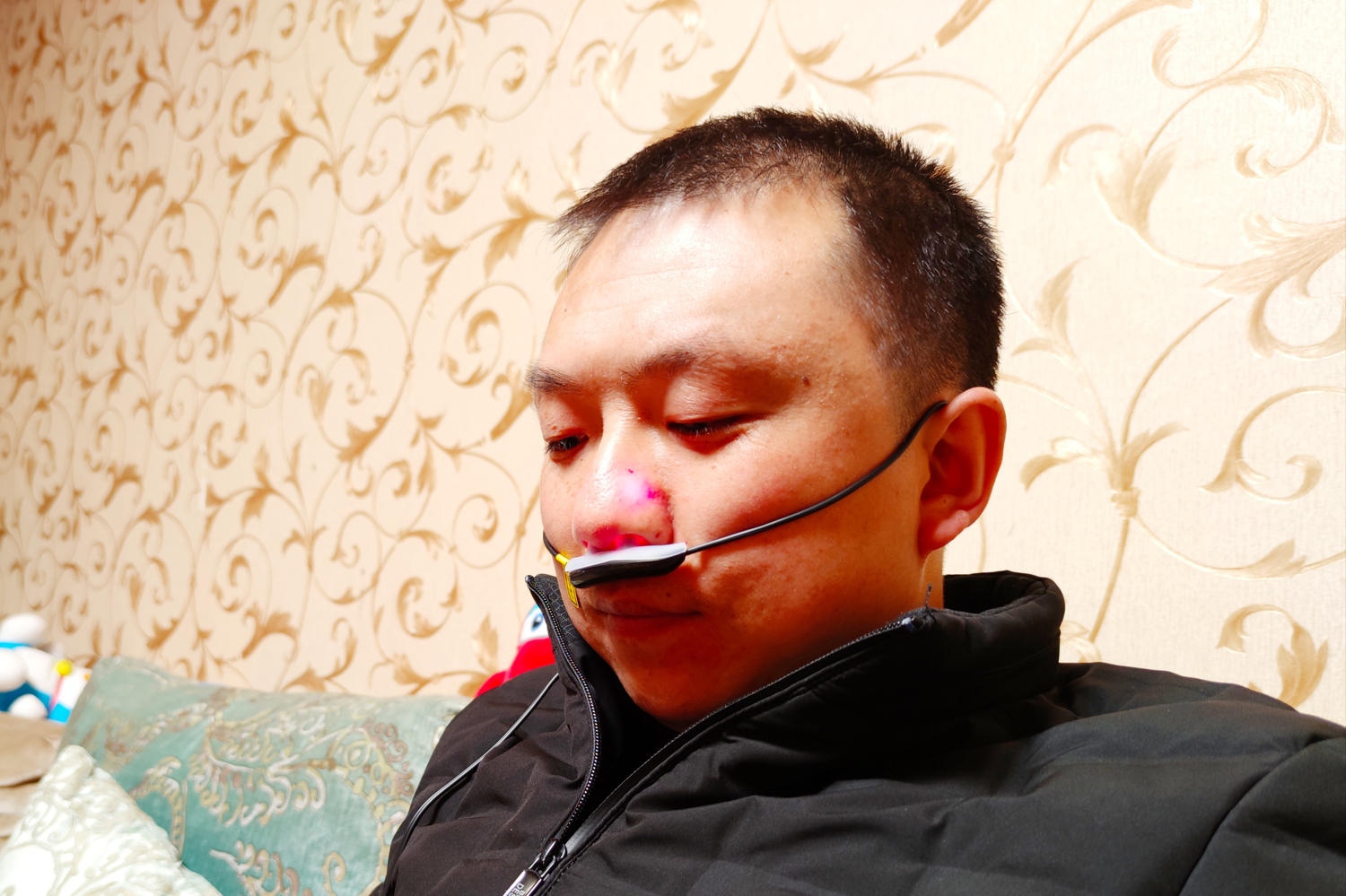 鼻炎建议用激光治疗吗,鼻炎反反复复有什么药物可以根治