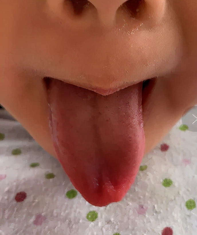 积食发热小儿推拿手法,治疗积食中药单方大全