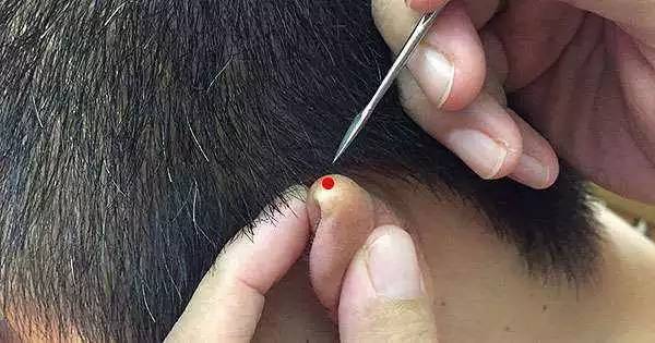 细谈针灸治疗上的一些原则问题