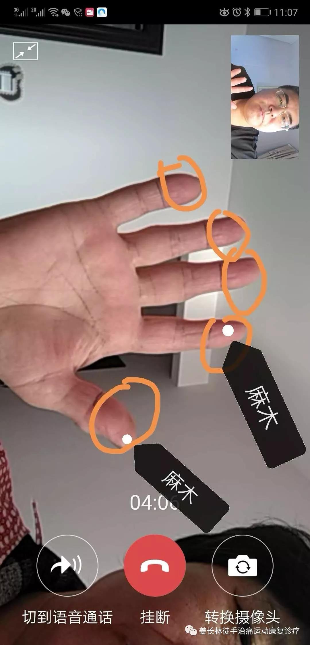 日常生活中的疼痛1—手麻(长时间玩手机)的判断和自我纠正