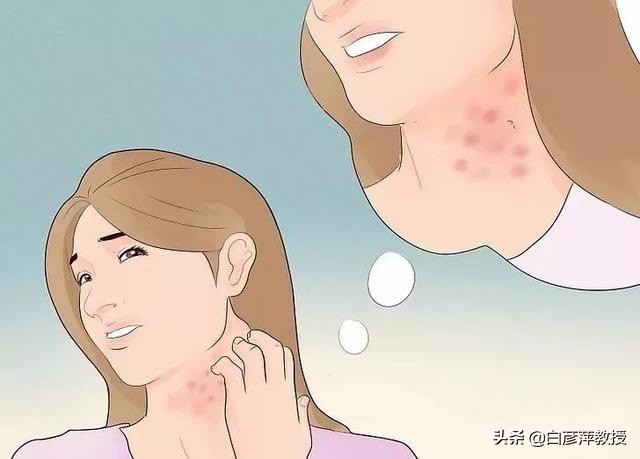 疥疮？一种奇痒又会传染的皮肤疾病