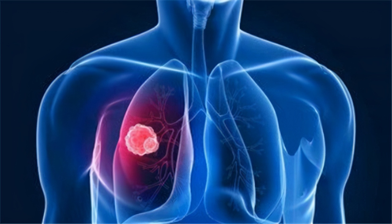 慢阻肺肺气肿的护理ppt,肺气肿不可逆怎么回事