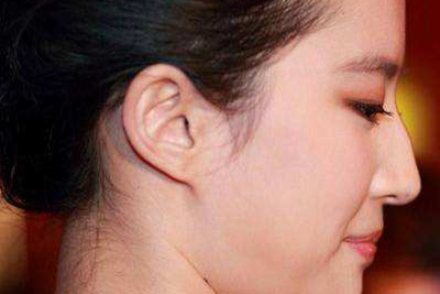 公认最丑的4种鼻型,全球公认最丑的四种鼻型