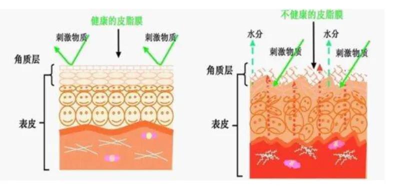皮肤有自我修复功能吗,受伤皮肤自我修复过程