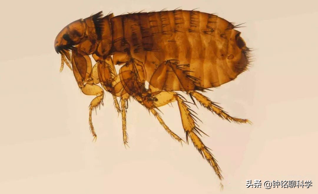 为什么虱子从21世纪就消失了,人类虱子的进化史