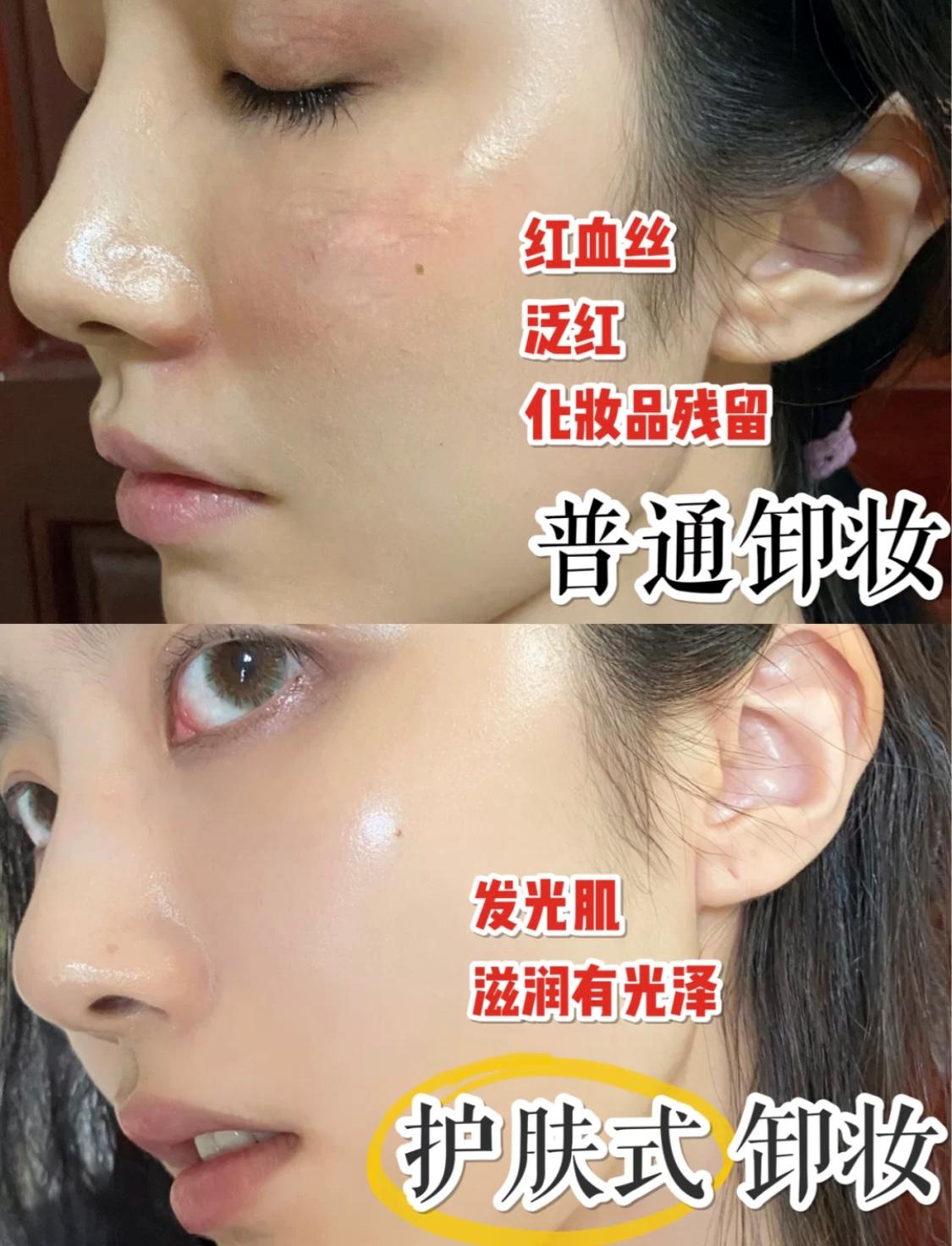 怎样正确使用卸妆油不长痘,再懒也要学会这4种护肤方法