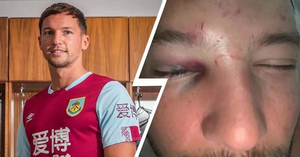 3年画风突变！英超冠军中场18个月没球踢醉驾+*戏调**女子活该被揍