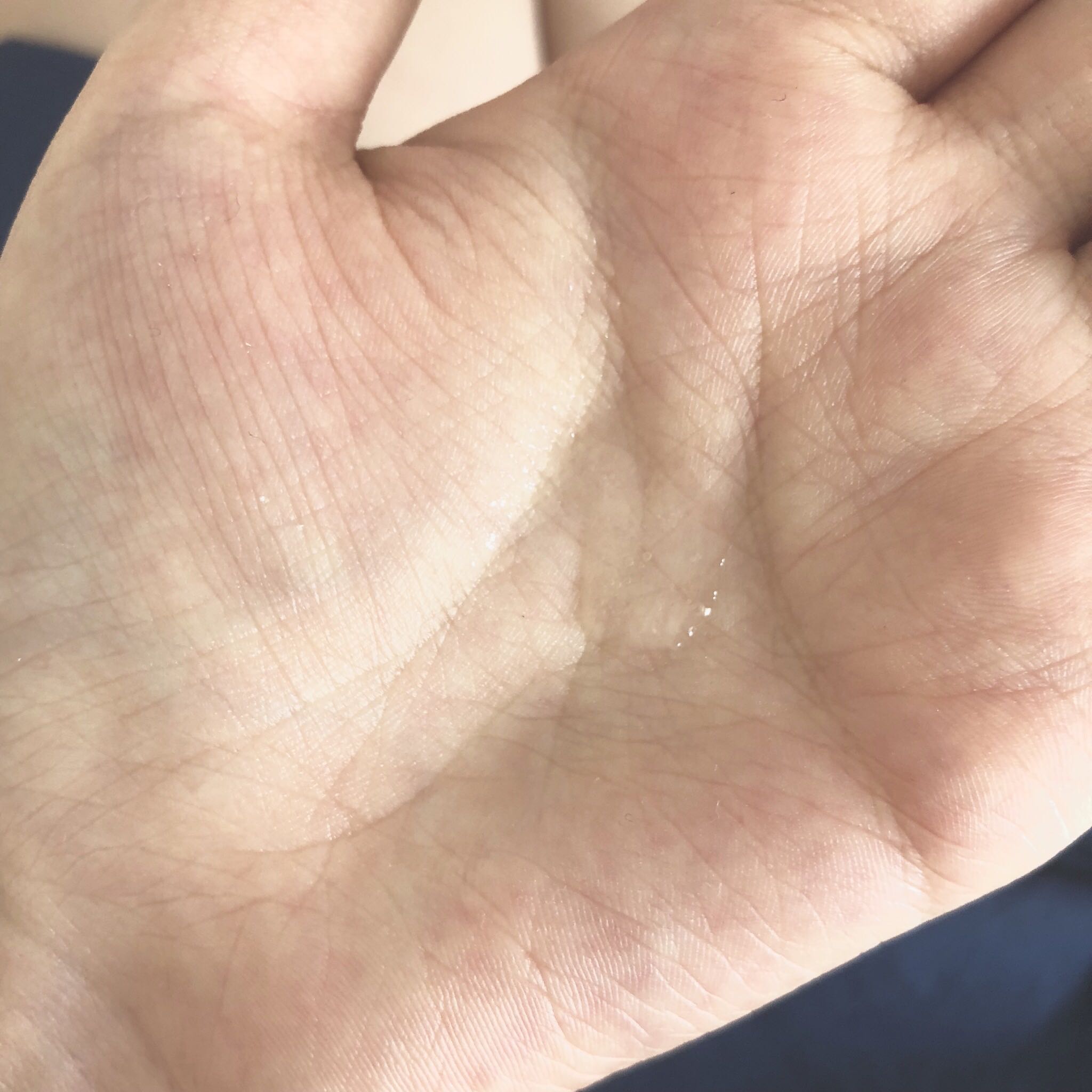 医生推荐的薇诺娜屏障特护霜,薇诺娜舒敏保湿特护霜修复角质层