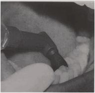 多图直击！牙医如何用抛光把孩子的牙洗干净？#葉子口腔科普#