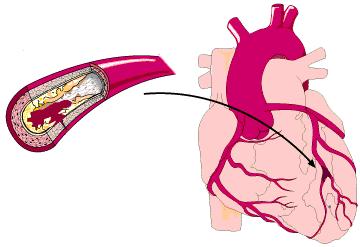 胆固醇要查什么才可以知道,胆固醇有一点点偏高医生没有开药
