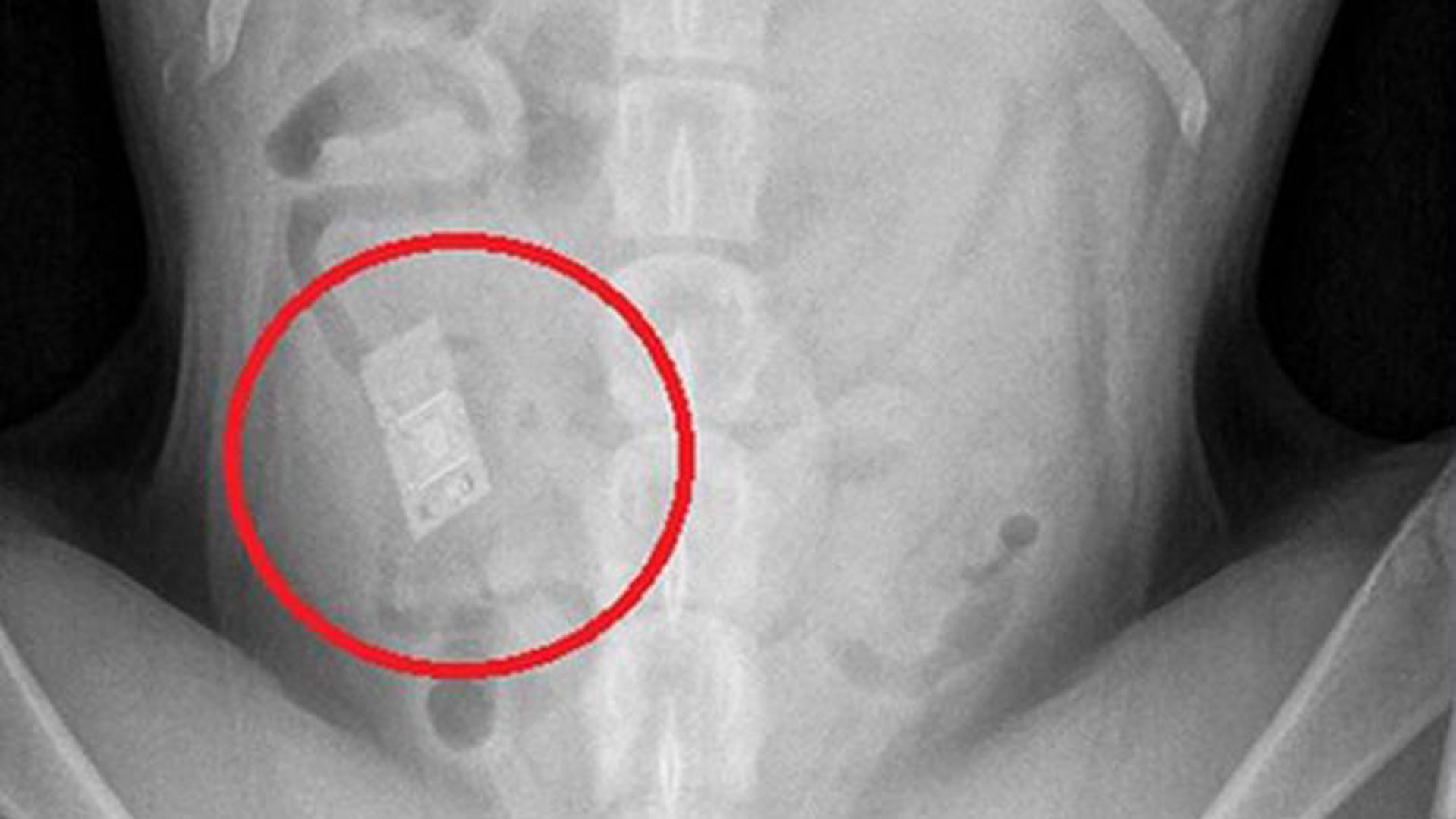 人误食了宠物零食怎么办,宠物误食异物需要拍片吗