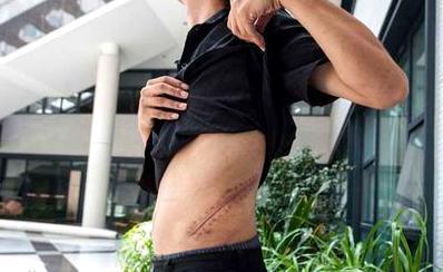 10年前，17岁高中生肾脏遭黑诊所切除，获赔147万却葬送人生