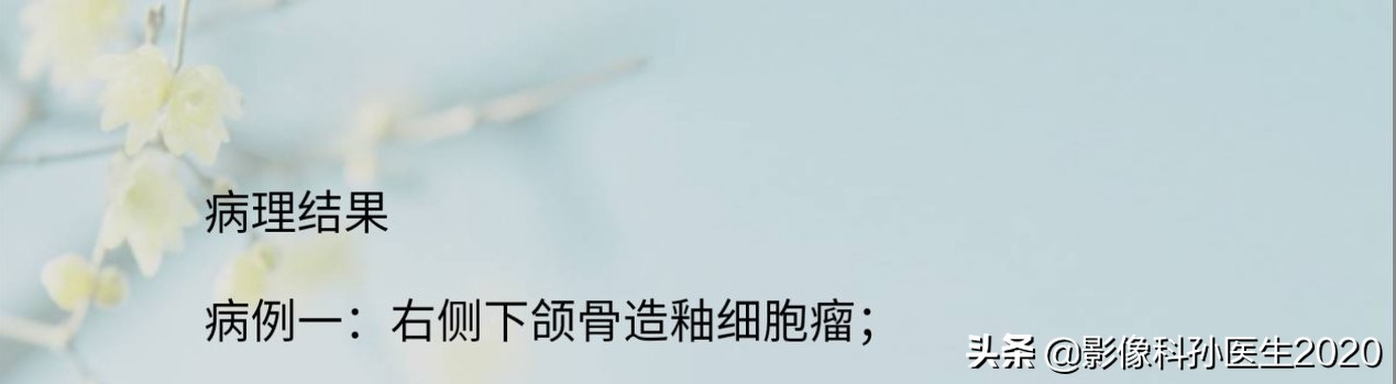 case10什么意思,case案例合集