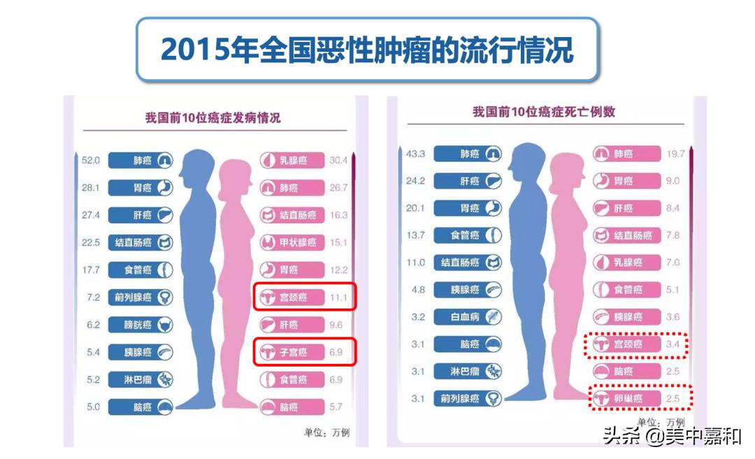 医生揭秘肿瘤放疗全过程,王斌医生讲解妇科