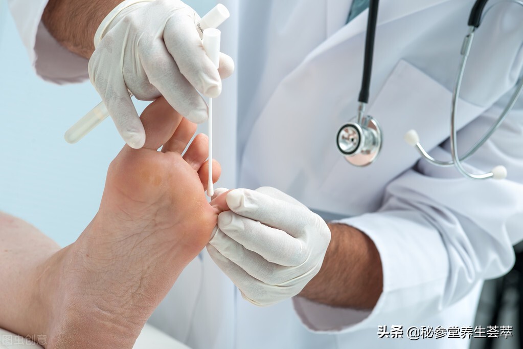 严重甲沟炎排脓放血,甲沟炎自行切开排脓