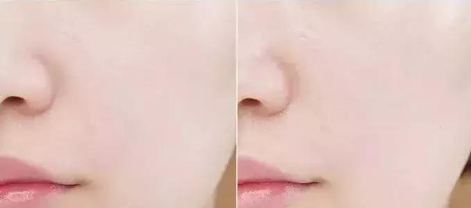 韩国维拉珠魔法药丸用洗吗,维拉珠魔法药丸可以用在眼部吗