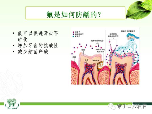 补牙齿龋齿全过程,补龋齿怎么做到无痛