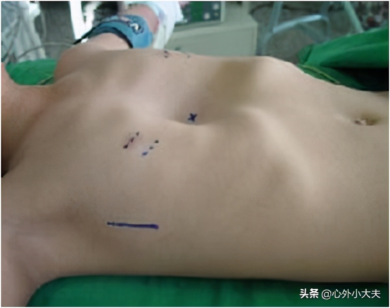 小儿外科常见疾病有哪些,儿童常见的外科疾病有哪些