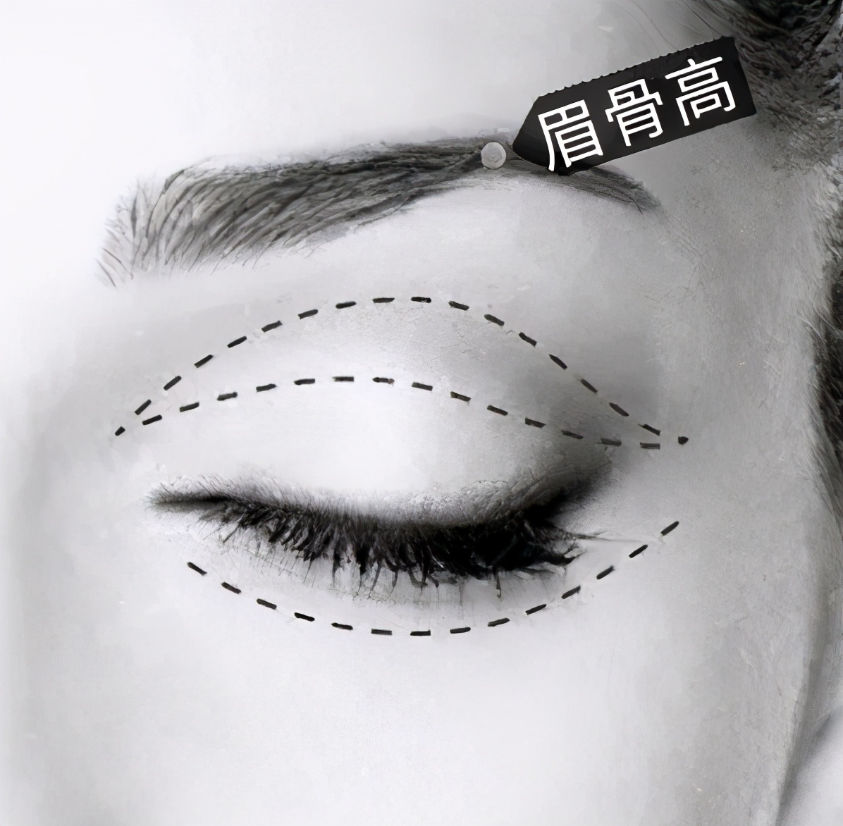 欧式双眼皮好看吗真的适合你吗,纯天然欧式双眼皮