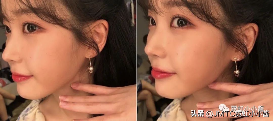 鼻子怎么修复好看呢,鼻型修复方法大全