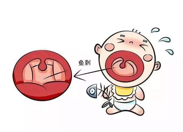 鱼刺卡住不去处理会怎样,三岁小孩被鱼刺卡住怎么处理