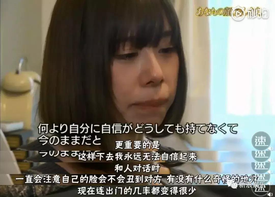 那些整容脸真的觉得自己好看吗,为什么整容以后都是一样的网红脸