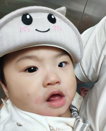 宝宝添加辅食后过敏怎么表现,宝宝添加辅食后便秘说让多喝水