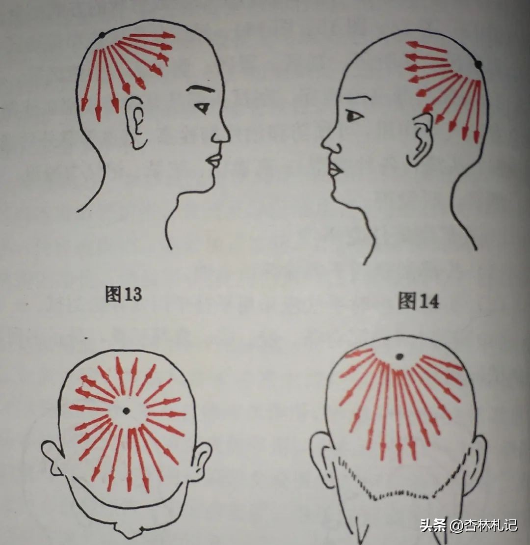 面部刮痧如何刮痧才有最佳效果,脸部怎么刮痧才是正确的方法