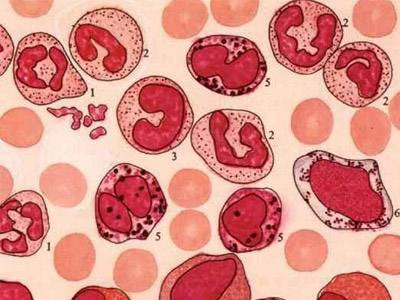 血液病再障有哪些症状,血液病患者如何预防出血