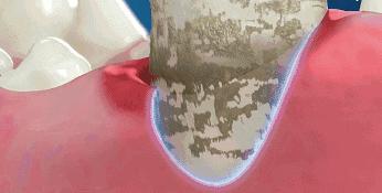 最好用的牙膏排行榜前十名,选哪个牌子的牙膏最安全好用