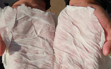 手凉手心老是出汗怎么解决,手心出汗怎判断是热汗还是凉汗