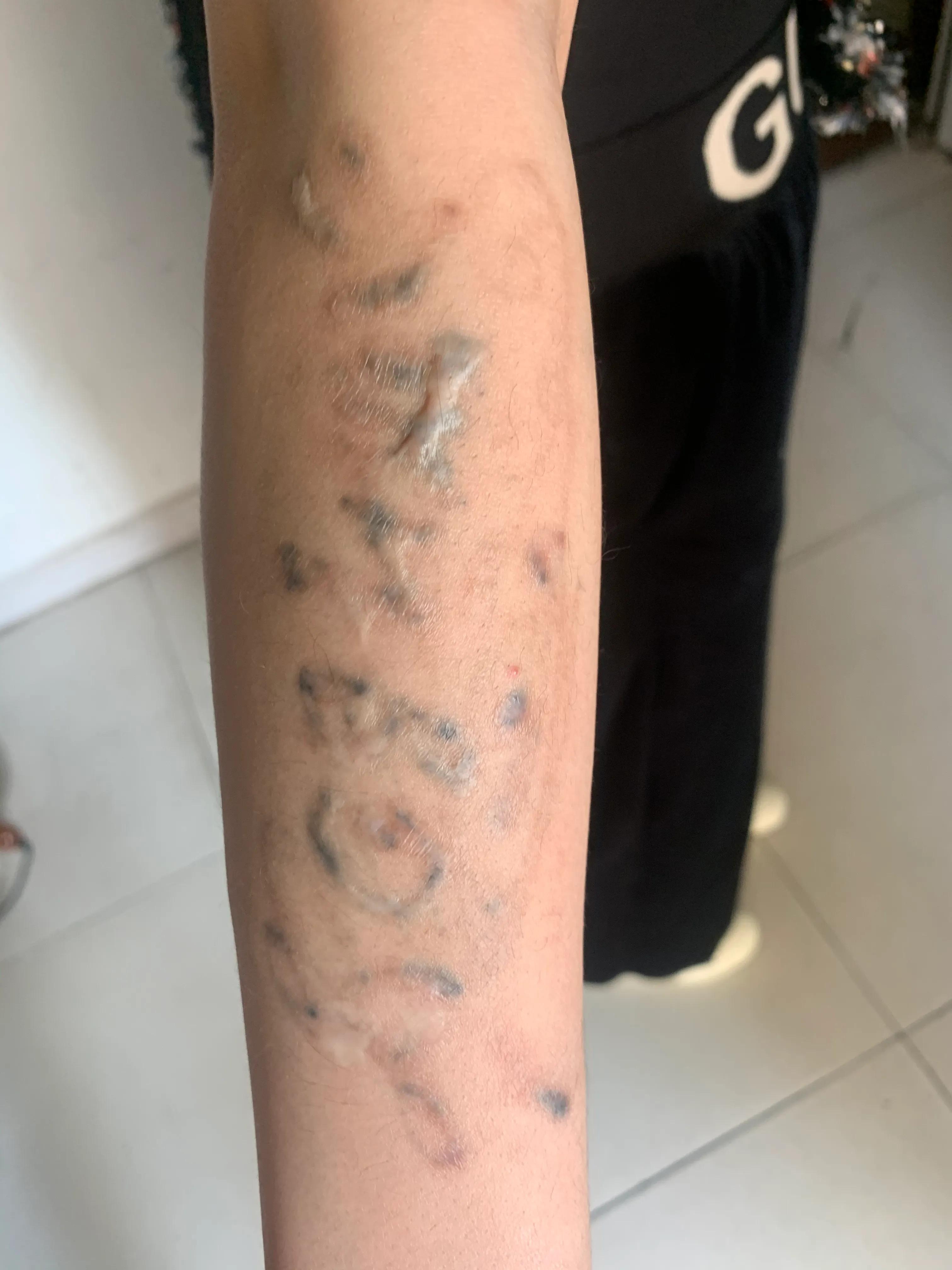 洗文身到底能不能洗干净？