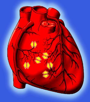 单硝酸异山梨酯、地尔硫卓、尼可地尔,3种抗心绞痛药有什么区别