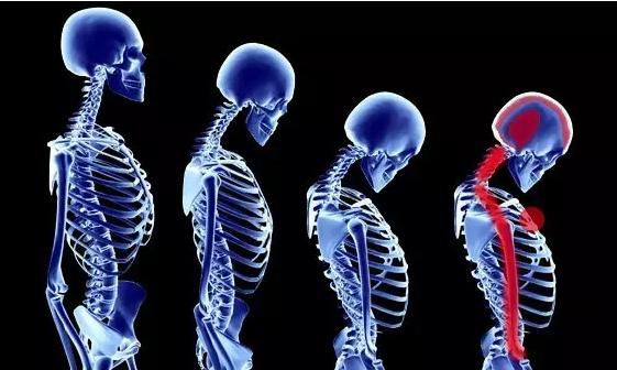 脖子颈椎受凉引起的疼怎么缓解,受凉颈椎痛和肩膀痛怎么缓解