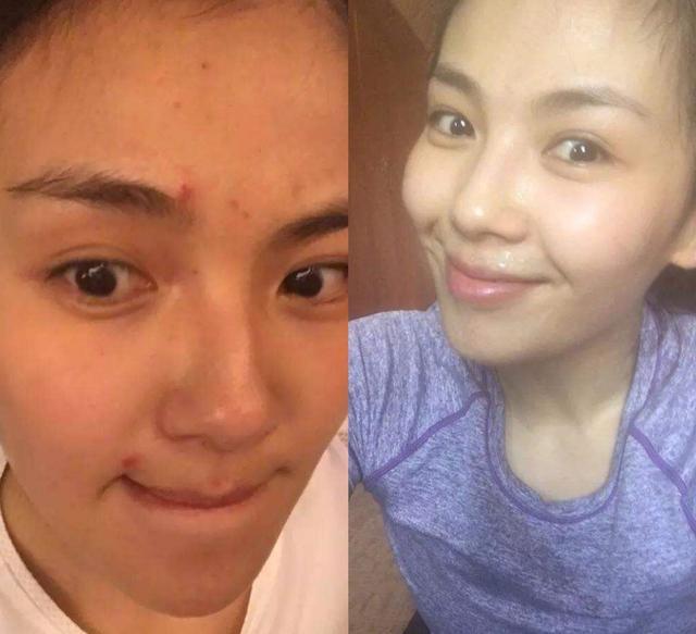 胶原蛋白该怎么补,脸上胶原蛋白流失严重怎么补最好