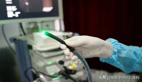 肠镜检查缓解尴尬的3个常识,关于胃肠镜检查你最关心的问题