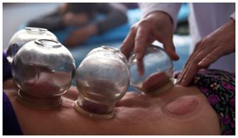 艾灸、刮痧、拔罐，在家里怎么做？中医专家教你诀窍