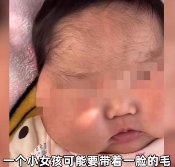 大头娃娃婴儿面霜,激素面霜导致的大头娃娃