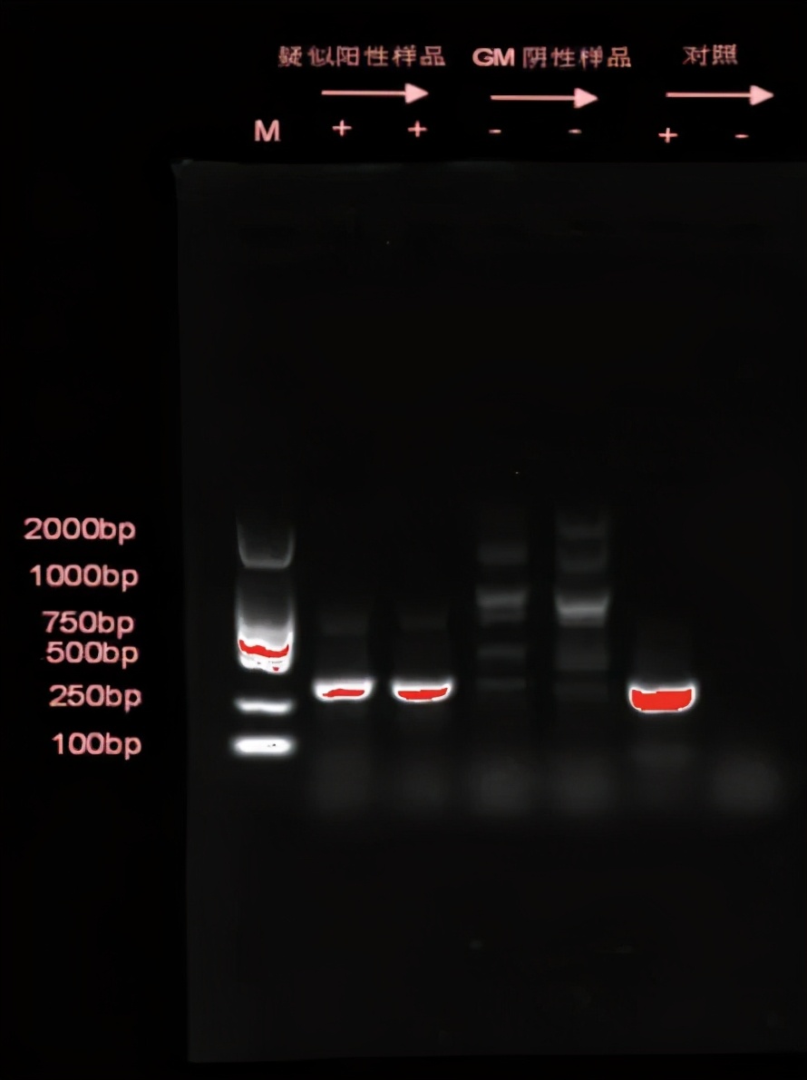 间质性肺病治疗后会加重吗,化疗后肺部间质性的病变