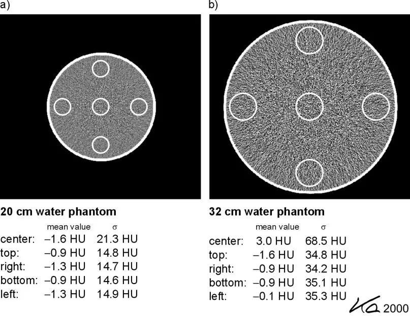 ct图像解析大全,ct图像与实物大小对比